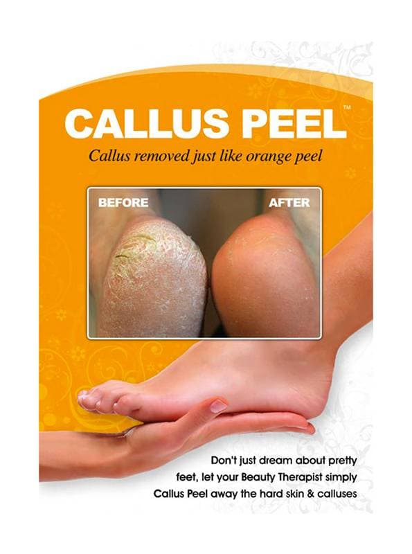 CALLUS PEEL - Poster A3